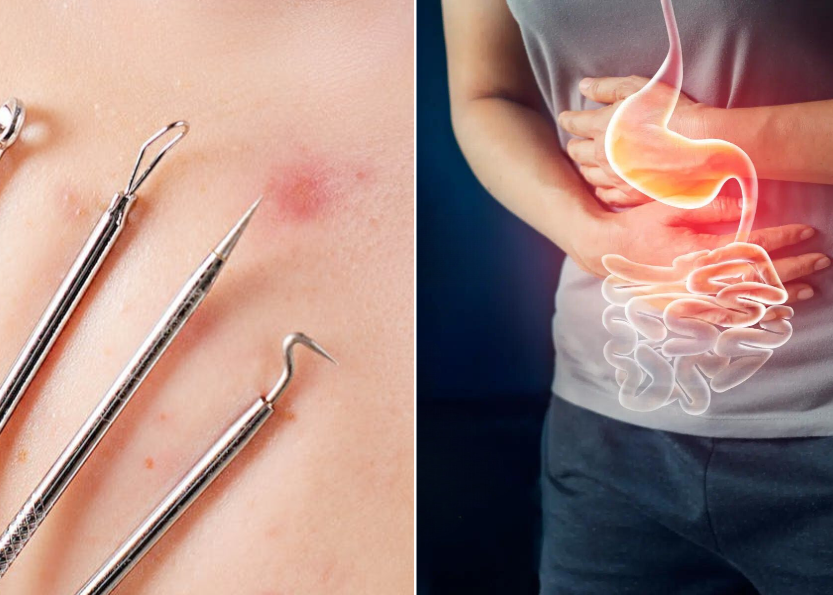Ten Signs Poor Gut Health